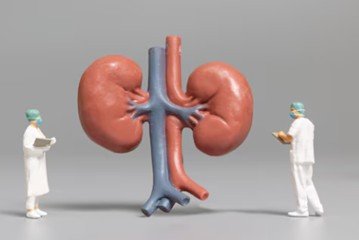 Médicos observam dois rins: um tumor renal pequeno, na prática clínica, é frequentemente utilizado para lesões sólidas renais de até 4 cm, embora o tamanho seja apenas um dos elementos considerados na decisão
